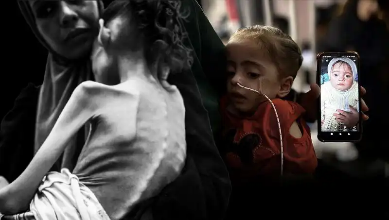 25 Kilodan 10 Kiloya Düşen Meryem'in Açlık Mücadelesi