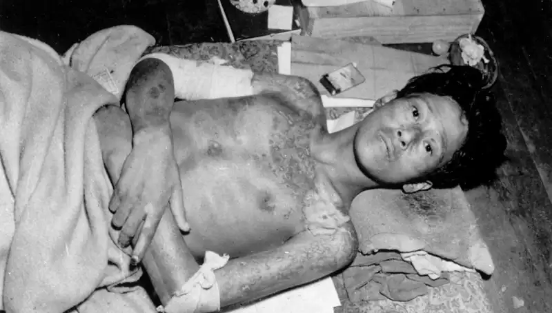 80 Yıl Sonra Nagasaki'den Uyanış: Nükleer Tehditlerle Yüzleşme Vakti Geldi